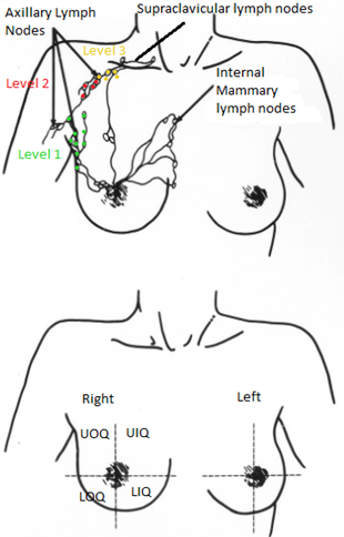 Top Image demonstrates the lymph nodes of the breast, bottom image demonstrates the quadrants of the breast.