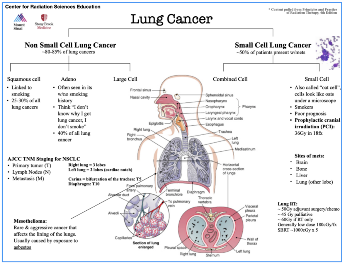 Lung cancer overview.