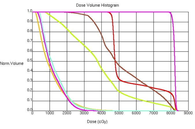 DVH for a VMAT of the prostate. Pink: PTV 7900 (100% of the volume is receiving 79 Gy); Red: PTV 4500 (Dose prescribed such that 96% of PTV4500 receives 45 Gy); Brown: Rectum (Majority of the rectum receives less than 60 Gy); Green: Bladder (90% of the bladder receives less than 65 Gy).