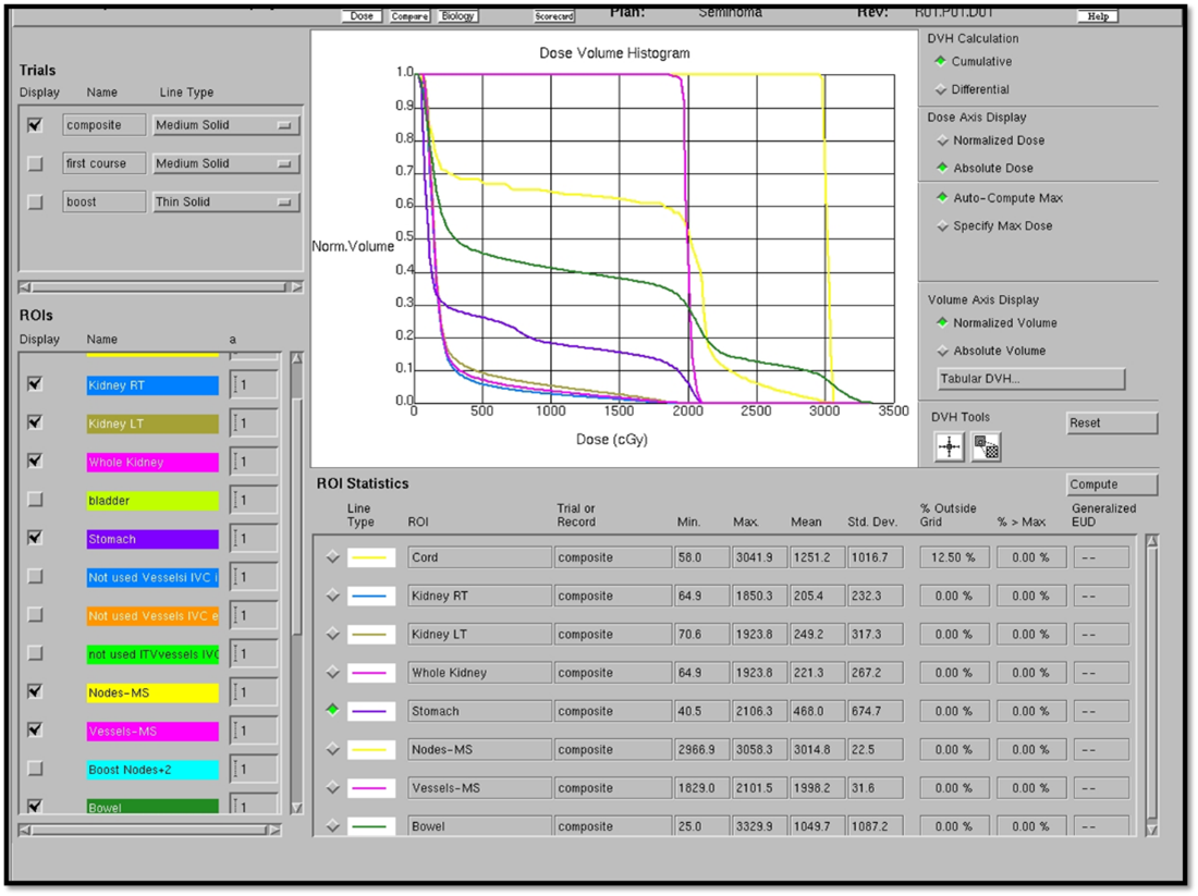 DVH for dogleg field (20 Gy) and boost fields (30 Gy).