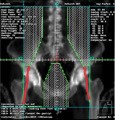 lower total nodal